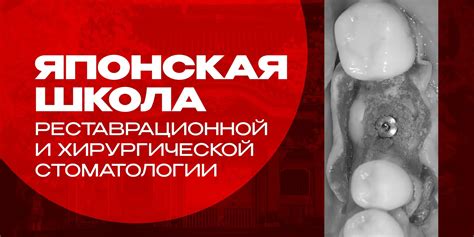 Оптимальная настройка дефлегматора: полезные рекомендации для достижения идеального результата