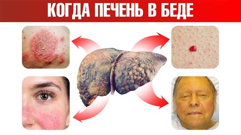 Болезни и заболевания