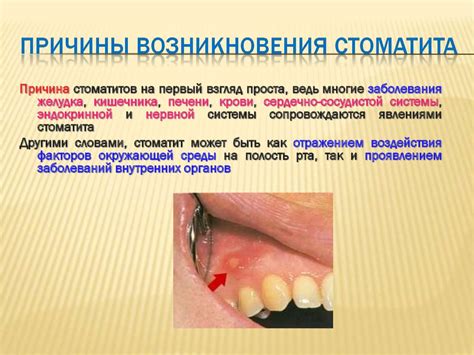 Болезни ротовой полости