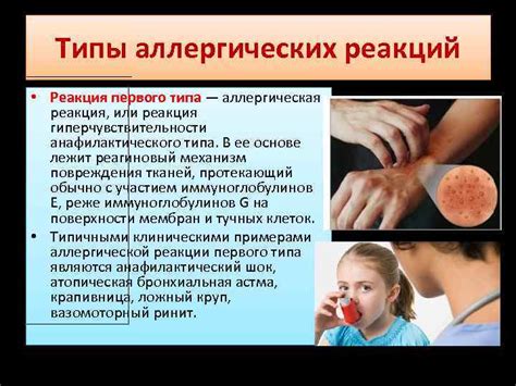 Болезнь или аллергическая реакция