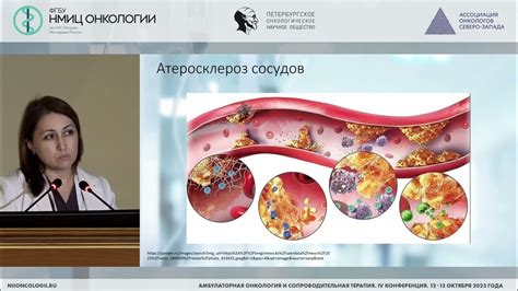Важность профилактики и лечения искривления шеи