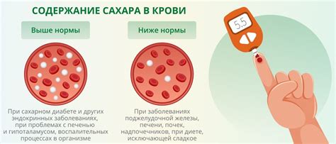 Влияние уровня сахара в крови на появление обморока