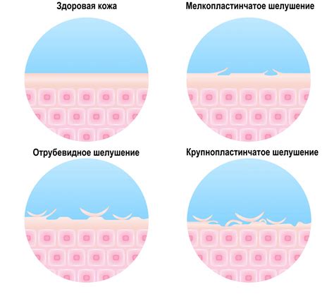 Возможные причины шелушения кожи