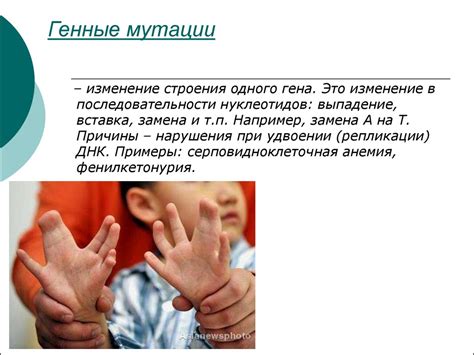 Врожденные аномалии и генетические мутации