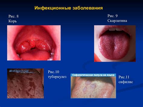 Заболевания слизистой оболочки
