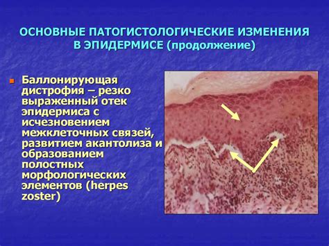 Изменения в эпидермисе