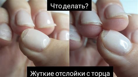 Как предотвратить зеленение ногтей под гель лаком
