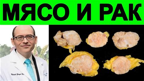 Медицинские аспекты тошноты от запаха вареного мяса