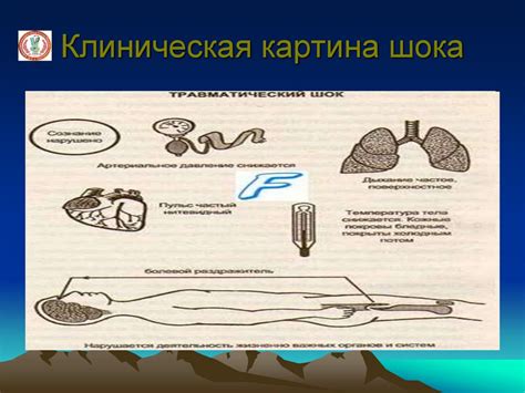 Механизмы, определяющие течение Плюс в Чароне