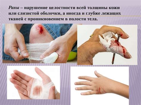 Механические повреждения педали