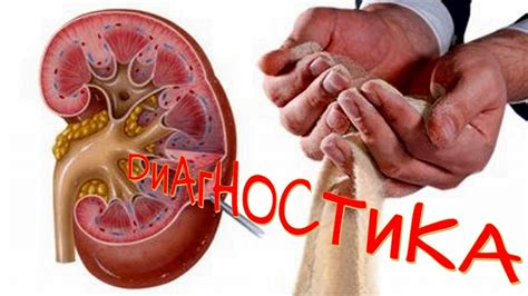 Нарушение деятельности почек