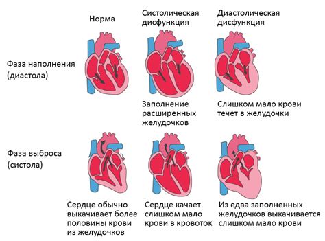 Недостаток кровообращения: причины и лечение