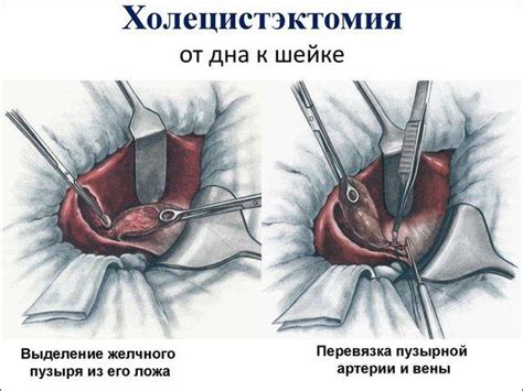 Осложнения после хирургического вмешательства