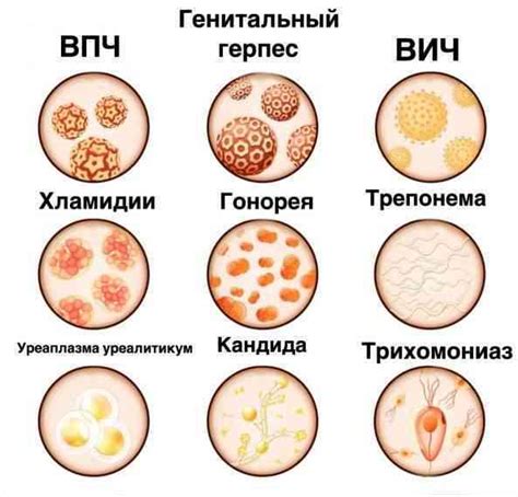 Передающиеся половым путем инфекции и корочки на половых губах