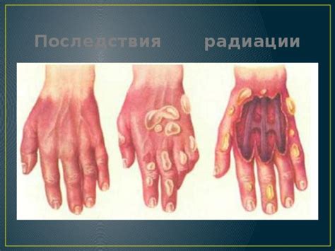 Последствия поражения