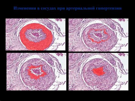 Постмертальные изменения в сосудах пальцев