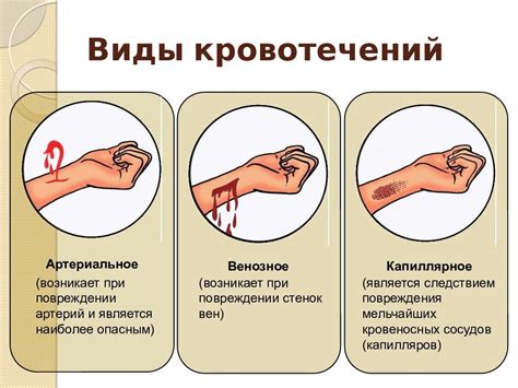 Почему кровь течет медленно после пиявок