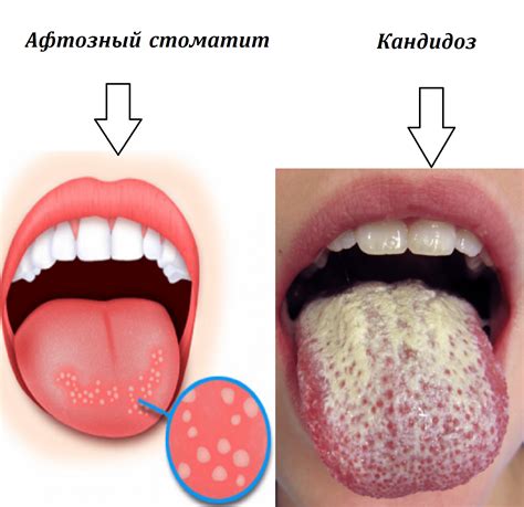Почему чеснок вызывает жжение во рту