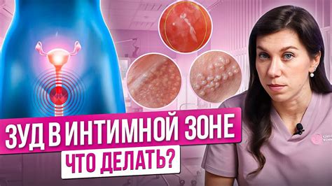 Причины зуда в паху при чесании пупка