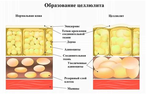 Причины появления разных мелодий