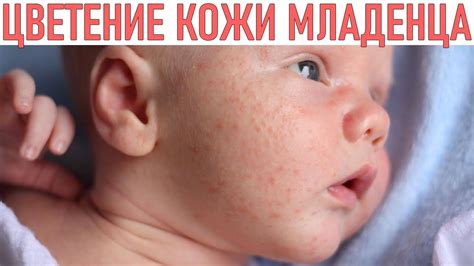 Проблемы с регулярным снабжением кожи кислородом