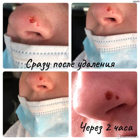 Рекомендации по крашению металла после удаления жира