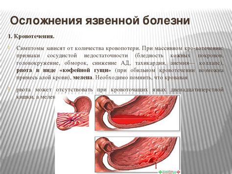 Сильные последствия при слишком мощном кровотечении