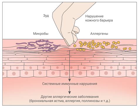 Сухость кожи и зуд на левой лопатке
