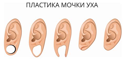 Трогание мочки уха как проявление нервозности