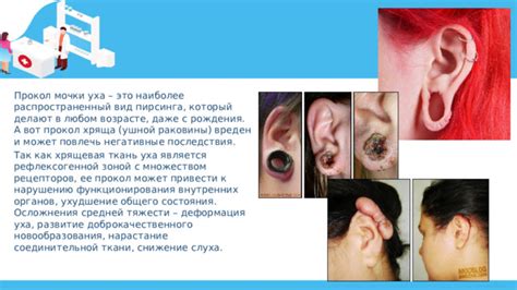 Ухудшение общего облика