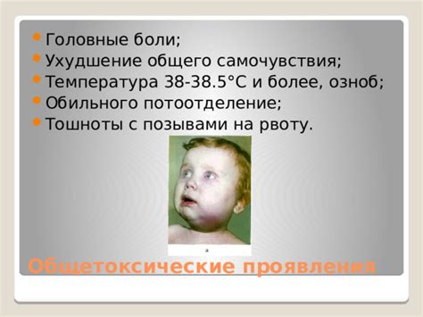 Ухудшение общего самочувствия