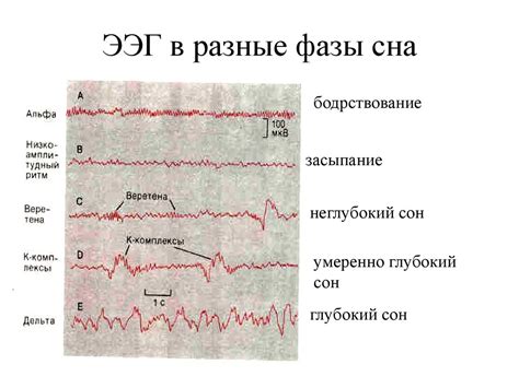 Физиологические причины сна как будто бы "током"