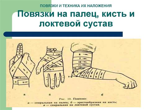 Фортуна и доля: связь повязки и контроля