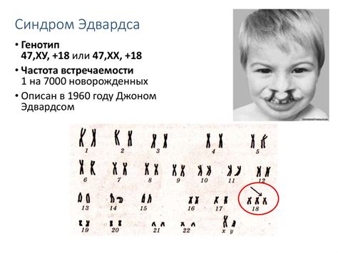 Хромосомные особенности и наследственность