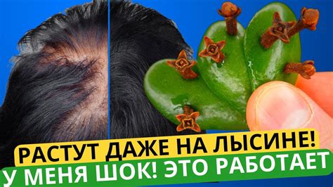 Чудо восстановления: волосы начинают расти снова после депиляции